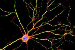 מדענים מאוניברסיטת קליפורניה בלוס אנג'לס - UCLA גילו כי דנדריטים (המוצגים כאן בירוק) אינם רק צינורות פסיביים לזרמים חשמליים בין תאי עצב. צילום: Shelley Halpain / UC בסן דייגו