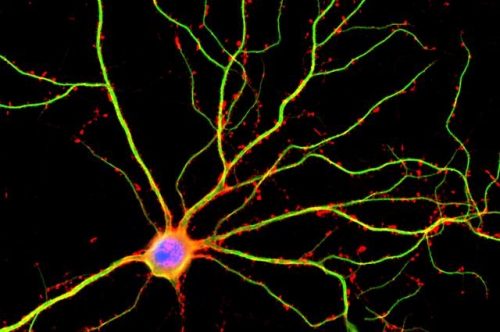 اكتشف علماء من جامعة كاليفورنيا في لوس أنجلوس أن التشعبات (الموضحة هنا باللون الأخضر) ليست مجرد قنوات سلبية للتيارات الكهربائية بين الخلايا العصبية. الصورة: شيلي هالبين / جامعة كاليفورنيا في سان دييغو