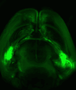 מוח עכבר במבט מלמעלה: שלוחות עצביות מחברות בין שתי האמיגדלות (שני האזורים הבוהקים ביותר, משני צידי המוח) לבין קליפת המוח (החלק העליון). מקור: מתוך המחקר.