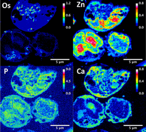 מתוך המחקר: מפת פליטת קרינה פלואורסצנטית של תאים שטופלו בתרכובת האורגנית-מתכתית. מקור: Dr. Carlos Sanchez-Cano et al. Synchrotron X-Ray Fluorescence Nanoprobe Reveals Target Sites for Organo-Osmium Complex in Human Ovarian Cancer Cells, Chemistry - A European Journal, 2017.