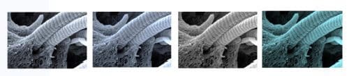 Collagen fibers in the process of enzymatic degradation. Sometimes the enzymes get out of control, and the cutting is done in an uncontrolled way. Source: Weizmann Institute magazine.