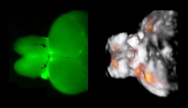 תוצאות דימות של מוח דג הזברה. משמאל: דימות במיקרוסקופ פלורוסצניה אופטי מספק רק תמונה מטושטשת המוגבלת לפני השטח. מימין: הגישה האופטו-אקוסטית FONT, לעומת זאת, מספקת תמונה תלת ממדית ברזולוציה גבוהה ומידע מפורט על פעילות הנוירונים (נקודות כתומות) בזמן אמת, בכל רחבי המוח. צילום: מרכז הלמהולץ, מינכן.