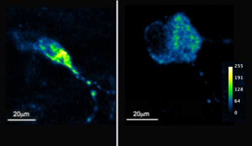 Decreased mitochondrial calcium uptake in cells where the MTCH2 gene has been neutralized. The photo on the left shows a nerve cell that has not been genetically modified. The photo on the right shows a transgenic nerve cell (without MTCH2). Fluorescent sensors were inserted into the cells in order to illuminate the absorption of calcium in the mitochondria, and calcium was added to the growth medium of the cells. As you can see, the sensors illuminate significantly less in the engineered cell (the color scale ranges from blue, indicating low calcium absorption, to yellow, indicating high calcium absorption), which indicates impaired calcium absorption in the mitochondria. Source: from the article.