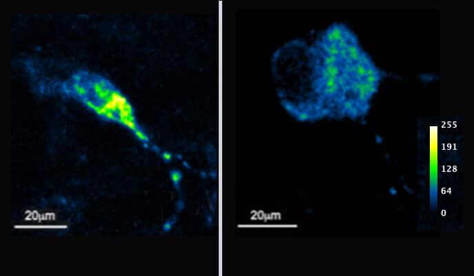 Decreased mitochondrial calcium uptake in cells where the MTCH2 gene has been neutralized. The photo on the left shows a nerve cell that has not been genetically modified. The photo on the right shows a transgenic nerve cell (without MTCH2). Fluorescent sensors were inserted into the cells in order to illuminate the absorption of calcium in the mitochondria, and calcium was added to the growth medium of the cells. As you can see, the sensors illuminate significantly less in the engineered cell (the color scale ranges from blue, indicating low calcium absorption, to yellow, indicating high calcium absorption), which indicates impaired calcium absorption in the mitochondria. Source: from the article.