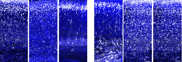 נדידת תאי העצב במוח של עוברי עכברים: במצב רגיל נודדים תאים רבים (נקודות לבנות) לשכבה העליונה של קליפת המוח (שלוש תמונות משמאל), אך בהיעדרו של החלבון 3C נותרו התאים פזורים לאורך מסלול הנדידה (שלוש תמונות מימין). צולם באמצעות מיקרוסקופ קונפוקלי. מקור: מגזין מכון ויצמן.