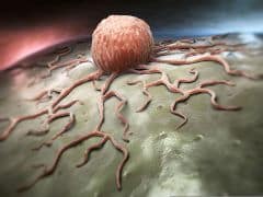 הדמייה של תא סרטני. מקור: טרייל-אין פארמה.