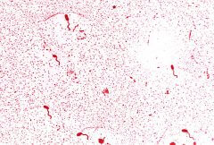 תצלום מוגדל של ויברוס כולרה. פוגע באלפי אנשים בתימן בימים אלה. מקור: CDC/Dr. Edwin P. Ewing, Jr / Wikimedia.