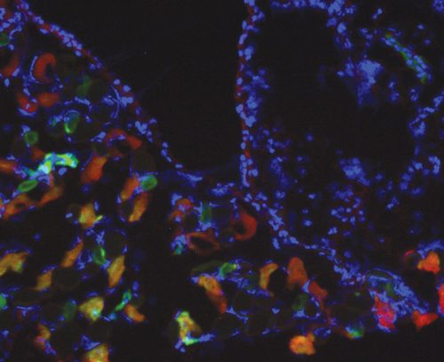 אזור הניתוח בקרום הצפק של עכבר. הסימון האדום מראה את הביטוי של LOX; הסימון הירוק מראה את ההיפוקסיה (מחסור בחמצן) בתאים. מקור: באדיבות הטכניון.