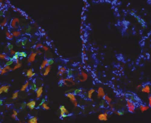 The area of ​​operation in the peritoneal membrane of a mouse. The red marking shows the expression of LOX; The green marking shows the hypoxia (lack of oxygen) in the cells. Source: Courtesy of the Technion.