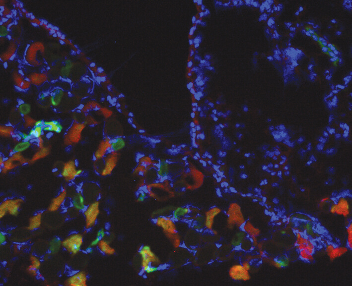 אזור הניתוח בקרום הצפק של עכבר. הסימון האדום מראה את הביטוי של LOX; הסימון הירוק מראה את ההיפוקסיה (מחסור בחמצן) בתאים. מקור: באדיבות הטכניון.