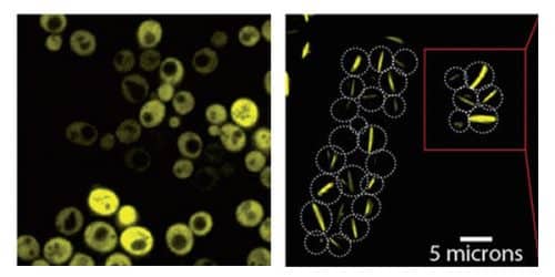 תאי שמרים אשר מייצרים צבר חלבונים סימטרי המורכב משמונה יחידות זהות. ללא מוטציה (משמאל) החלבונים מתפזרים באופן חופשי בתוך התא, אבל מוטציה אחת (מימין) גורמת להרכבה עצמית בצורת סיבים ארוכים. מקור: מגזין מכון ויצמן.