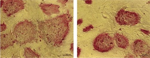 Embryonic stem cell colonies as seen under a microscope: the cells differentiated in an orderly manner when their genome contained a normal copy of the p53 gene (left), but not when p53 was missing (right). Source: Weizmann Institute magazine.