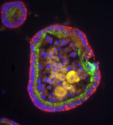 מבנה תאי עגול בגודל כ-0.5 מילימטר, אשר מחקה במבחנה את חתך המעי. בשכבתו העליונה ממוקמות מולקולות אר-אן-אי שליח של שני גנים שונים (אדום וירוק) בשני צידי הגרעין של התאים (כחול). מקור: מגזין מכון ויצמן.