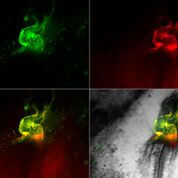 القلب المبكر في جنين الدجاجة. يمكن رؤية خلايا القلب الجنيني من خلال التعبير عن بروتينات الفلورسنت تحت سيطرة الجينات Nkx2-5 (الأخضر) وIsl1 (الأحمر). المصدر: مجلة معهد وايزمان.