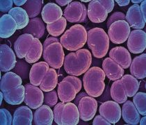 חיידקי Neisseria gonorrhoeae האחראחים למחלת הזיבה. מקור: NIAID.
