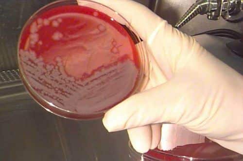 חיידקים קטלניים: מושבות של בצילוס אנתרציס שגודלו על מצע אגר במעבדה. מקור: U.S. Army Medical Research Institute of Infectious Diseases.