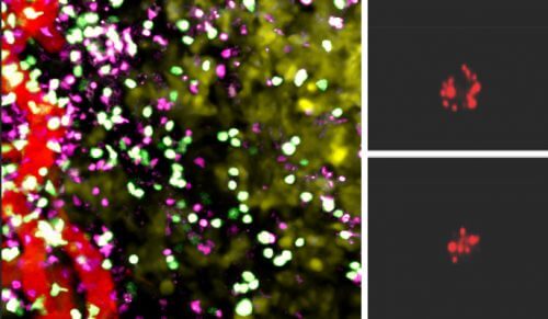 משמאל: גידול סרטני תחת מיקרוסקופ: חדירת תאי T רגילים (סגול) לרקמת הגידול אינה שונה מזו של תאי T אשר גודלו בתנאי מחסור בחמצן (ירוק). מימין: כמות האנזים "גרנזיים B" (אדום), אשר הורג תאי סרטן, גדולה בהרבה בתאי T אשר גודלו בסביבה דלת חמצן (למעלה) לעומת תאי T רגילים (למטה). מקור: מגזין מכון ויצמן.