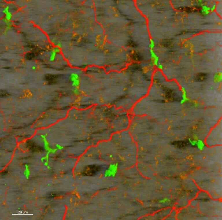 מקרופאגים (בירוק) ואקסונים (באדום) ברקמת שומן חום. צולם באמצעות מיקרוסקופיה דו-פוטונית. מקור: מגזין מכון ויצמן.