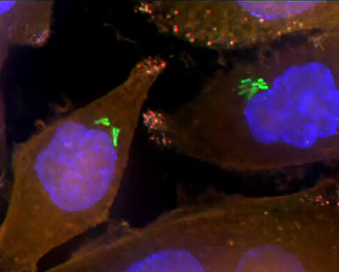 Bacteria (in green) inside pancreatic cancer cells (AsPC-1 cells). The nuclei of the cells are colored in blue and the intracellular fluid in orange. Source: Weizmann Institute magazine.
