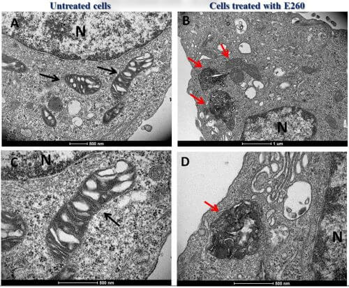 התמונות המצורפות מראות כיצד משפיע E260 באופן דרמטי על המיטוכונדריה של תאים גרורתיים. מתוך המחקר.