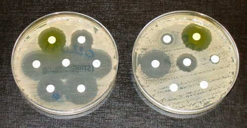 אילוסטרציה - בתמונה נראות שתי צלחות פטרי, כשבשמאלית חיידקים שאינם עמידים לאנטיביוטיקה הנמצאת בדיסקים הלבנים הקטנים, ובימנית החיידקים עמידים לאנטיביוטיקה. צילום: Dr Graham Beards, Wikimedia.