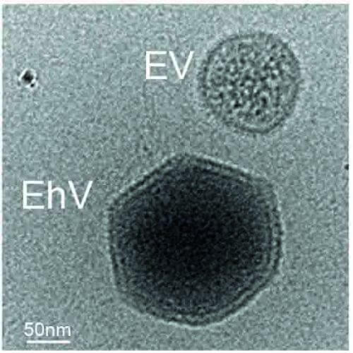 הווירוס (EhV) והבועית (EV) במיקרוסקופ אלקטרונים קריוגני. מקור: מגזין מכון ויצמן.
