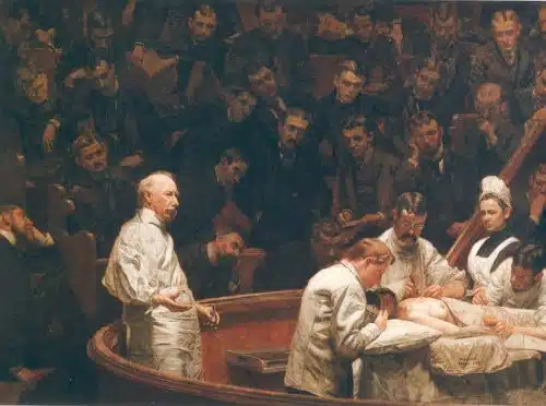מרפאת אגניו, ציור מ-1889 מאת תומס איקינס, מתאר אולם ניתוחים אמריקני לאחר הופעת ההרדמה הכללית. מקור: Thomas Eakins.