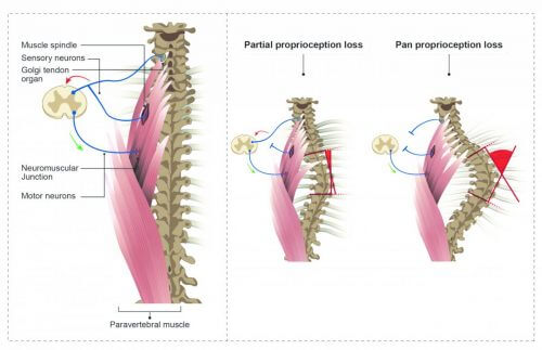 מנח תקין של עמוד השדרה (משמאל) והתפתחות עקמת בעקבות היעדר מלא (מימין) או חלקי (במרכז) של קולטני חישה מכניים. באדיבות מגזין מכון ויצמן.