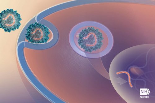 איור המציג ריפוי גני באמצעות החדרת וירוס בלתי מזיק, שנקרא AAV. מקור: National Human Genome Research Institute.