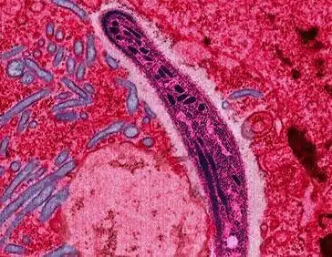 טפיל Plasmodium הגורם למחלת המלריה. מקור: Ute Frevert / Margaret Shear / Wikimedia Commons.