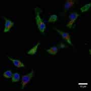 הפריטין אינו נמצא במסלול ההפרשה הקלאסי של התא. מיקום פיזור הפריטין (ירוק) ופיזורו בתאים מקרופאגים שמקורם במח עצם אינו מושפע מחומר הפוגע במסלול ההפרשה הקלאסי אברון הג'ולג'י (אדום). באדיבות הטכניון.
