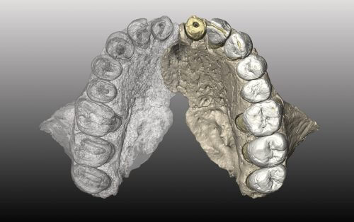 מבט על קשת השיניים (החלק השמאלי הוא המקור החלק הימני משוחזר). כול השיניים למעט החותכת המרכזית נמצאות. הקשת קטנה ופרבולית והמורפולוגיה של השיניים מודרנית. באדיבות אוניברסיטת תל אביב.