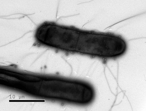 נגיפים (נראים בתמונה כעיגולים קטנים) תוקפים חיידקים. מערכות חיסון מתוחכמות. מקור: מגזין מכון ויצמן.