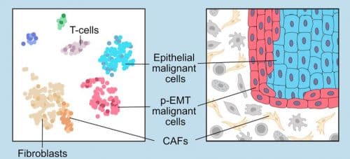ריצוף אר-אן-איי של תאים בודדים מאפשר למפות את המערכת האקולוגית של תאי הסרטן. התאים הסרטניים שנמצאים בתהליך הפיכה לתאים אחרים (באדום) מצויים בשוליים החיצוניים של הגידול. מקור: מגזין מכון ויצמן.