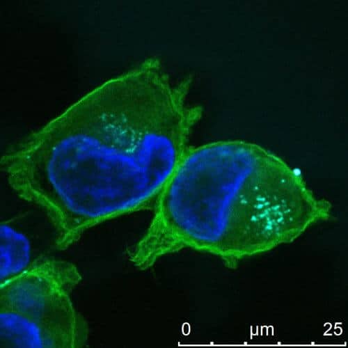 חדירה של ננו-חלקיקים (תכלת) המכילים רצפי רנ"א קצרים לתוך תאי סרטן לבלב (מסומנים בירוק וגרעין התא שלהם מסומן בכחול). צולם במיקרוסקופ קונפוקלי ע"י הדס גיבורי, אוניברסיטת תל אביב.