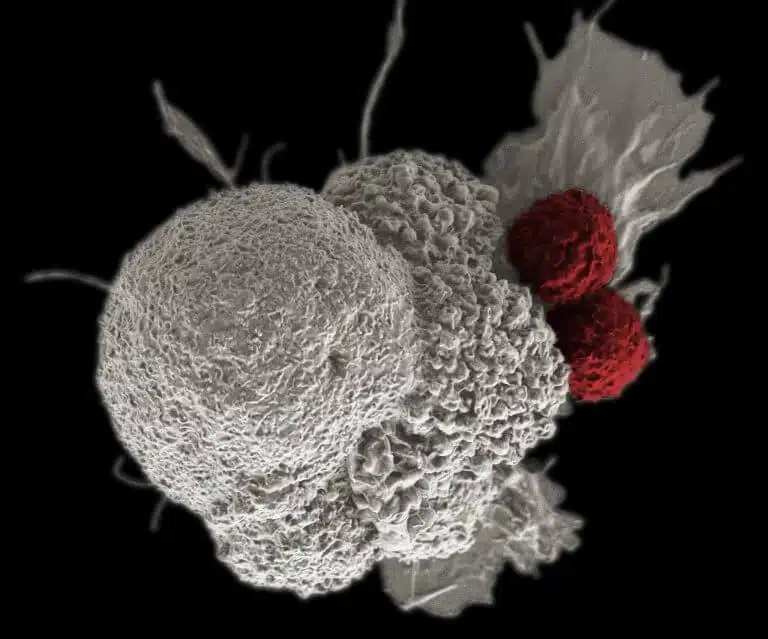 Cytotoxic T white blood cells (in red) attack a cancer cell. Illustration: Elena Serda, Duncan Comprehensive Cancer Center at Baylor College of Medicine, National Cancer Institute, National Institutes of Health.