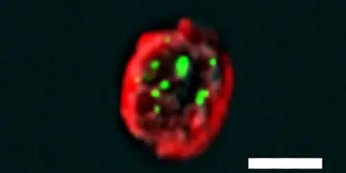 "السيلفي" الخلوية: خلية mTEC تم تصويرها باستخدام الطريقة الجديدة المسماة PLIC. تشير النقاط الخضراء إلى وجود تفاعل بين البروتينات مما يساعد على منع حدوث هجوم مناعي ذاتي. المصدر: مجلة معهد وايزمان.