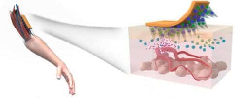 איור רעיוני של מדבקה נושאת מיקרו-מחטים לטיפול בחולי סכרת מסוג 2. [באדיבות: Chen lab, NIBIB]