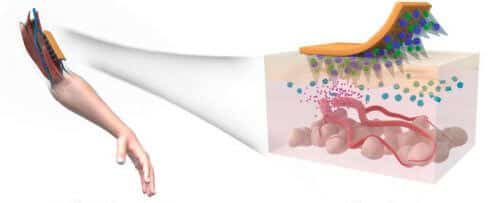 Conceptual illustration of a patch carrying microneedles for the treatment of type 2 diabetes patients. [Courtesy: Chen lab, NIBIB]