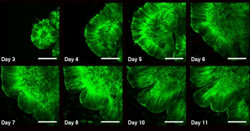 11 days in the laboratory: the development of the brain organoid and the appearance of the folds starting in the second week. Photo: Prof. Orly Reiner, Weizmann Institute