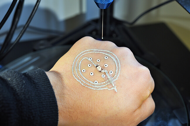 One of the innovative features of the XNUMXD printing method on the skin is the printer's ability to use computer vision to track and adapt to the body's movements in real time University of Minnesota] McAlpine [Courtesy: Group