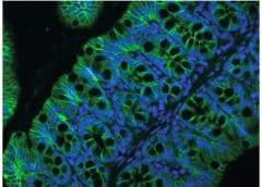 חלבונים המעורבים בתפקוד של מחסום המעי (החלבון E-cadherein מסומן בירוק)