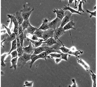 תאי סרטן השד בתרבית כפי שהם נראים תחת מיקרוסקופ אופטי. אפשר להבחין ברצועות המחברות בין התאים. צילום: פרופ' גייגר, מכון ויצמן