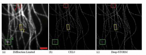 From left to right: the original microscope image, the original reconstruction using the CELO method and the reconstruction using the method developed at the Technion