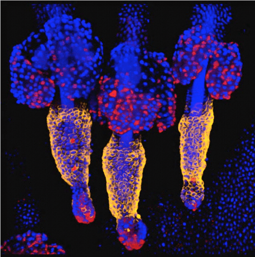 A trio of hair follicles and sebaceous glands. The stem cells are colored in orange, and cells positive for active caspase-3 - in red. Technion illustration