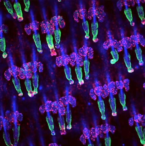 Hair follicles and sebaceous glands in the skin. The stem cells are colored in green and the dividing cells in red. Technion illustration