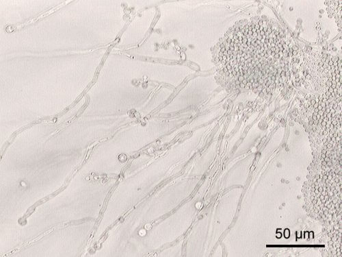 המין Candida albicans בהגדלה של פי 200. מתוך ויקיפדיה