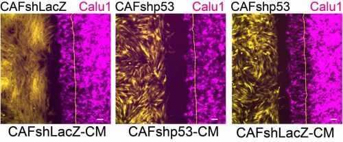 تأثير p53 في الخلايا الليفية على هجرة الخلايا السرطانية: تهاجر الخلايا السرطانية (الأحمر الأرجواني) نحو الخلايا الليفية الداعمة للسرطان (الصفراء) معبرة عن الجين p53 (يسار)؛ يتم تقليل الهجرة (في الوسط) عندما يتم إسكات p53 في الخلايا الليفية؛ عندما تتم إضافة المواد التي تفرزها الخلايا الليفية الداعمة للسرطان إلى مزرعة الخلية، تعود الهجرة إلى وضعها الطبيعي (على اليمين). الرسوم التوضيحية، معهد وايزمان
