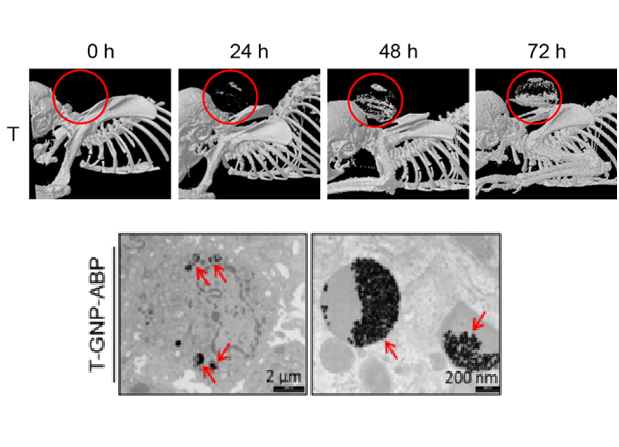 In the top row, CT images of an animal with cancer before (0h) and 24-72 hours after injection of 10 nm contrast agents into the circulation. The cancerous tissue is marked in the red circle. The accumulation of the contrast material in the tumor can be seen with micro CT in small animals. In the bottom row, an electron microscope image of cancer tissue, demonstrating a single cancer cell (left) from an animal injected with a contrast medium containing 30 nm gold particles. The dark particles are gold particles marked with red arrows. On the right - magnification of organelles from the same cell containing the contrast agents.