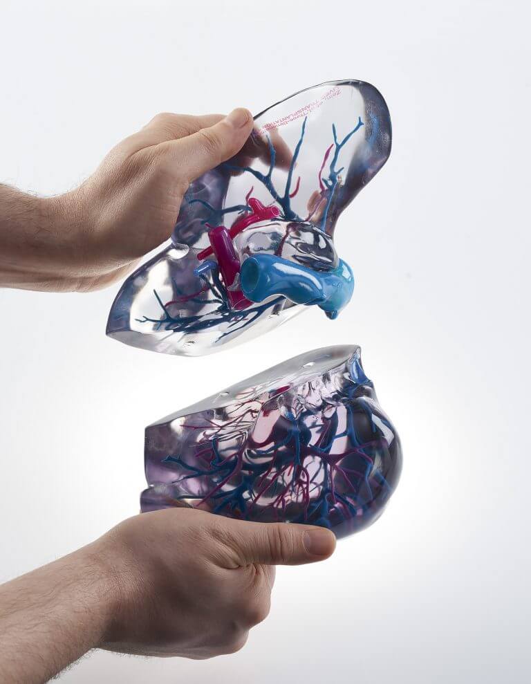 A model of a liver printed on a Stratasys XNUMXD printer, photo - courtesy of the Stratasys company